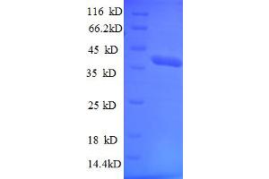 SDS-PAGE (SDS) image for Tripartite Motif Containing 11 (TRIM11) (AA 267-468), (partial) protein (His-SUMO Tag) (ABIN5711713) (TRIM11 Protein (AA 267-468, partial) (His-SUMO Tag))