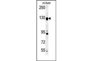 Western blot analysis of MGC24039 Antibody (C-term)  in mouse liver tissue lysates (15ug/lane). (MGC24039 (AA 1073-1102), (C-Term) anticorps)
