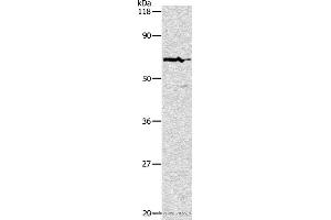 Western blot analysis of Hela cell, using PKM2 Polyclonal Antibody at dilution of 1:500 (PKM anticorps)