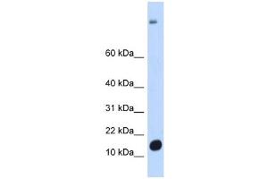 C6ORF201 antibody used at 1 ug/ml to detect target protein. (C6orf201 anticorps  (N-Term))