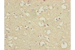 Immunohistochemistry of paraffin-embedded human brain tissue using ABIN7151390 at dilution of 1:100 (ENPP6 anticorps  (AA 31-330))