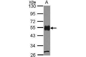 WB Image Sample (30 ug of whole cell lysate) A: JurKat 10% SDS PAGE CD2 antibody antibody diluted at 1:1000 (CD2 anticorps  (C-Term))
