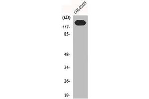 Western Blot analysis of C0L0205 cells using N-cadherin Polyclonal Antibody (N-Cadherin anticorps  (C-Term))