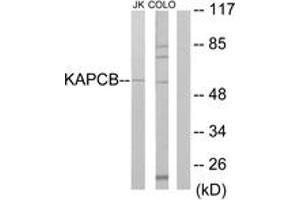 Western blot analysis of extracts from Jurkat/COLO205 cells, using KAPCB Antibody. (PRKACB anticorps  (AA 291-340))