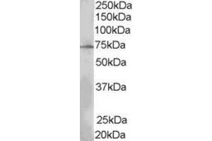 Western Blotting (WB) image for anti-SH2B Adaptor Protein 3 (SH2B3) (N-Term) antibody (ABIN2465907) (SH2B3 anticorps  (N-Term))