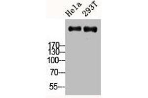 Western Blot analysis of HELA 293T cells using Ki-67 Polyclonal Antibody (Ki-67 anticorps  (C-Term))
