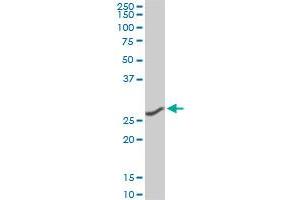 CNOT7 monoclonal antibody (M01A), clone 2F6. (CNOT7 anticorps  (AA 1-285))