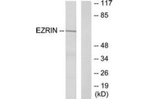 Western blot analysis of extracts from A431 cells, treated with EGF 200ng/ml 30', using Ezrin (Ab-353) Antibody. (Ezrin anticorps  (AA 321-370))