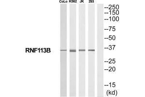 Western Blotting (WB) image for anti-Ring Finger Protein 113B (RNF113B) (Internal Region) antibody (ABIN1852492) (RNF113B anticorps  (Internal Region))