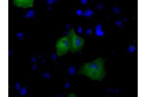 Immunofluorescence (IF) image for anti-Bruton Agammaglobulinemia tyrosine Kinase (BTK) antibody (ABIN1496977) (BTK anticorps)