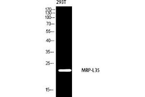 Western blot analysis of 293 using MRP-L35 antibody. (MRPL35 anticorps  (AA 80-160))