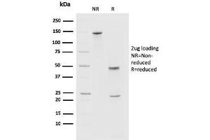 SDS-PAGE Analysis of Purified PD1 (CD279) Mouse Monoclonal Antibody (PDCD1/2720). (PD-1 anticorps)