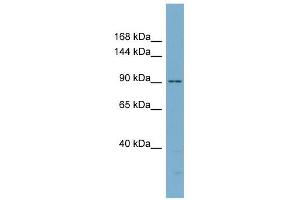 Catenin antibody used at 1 ug/ml to detect target protein. (Catenin anticorps)