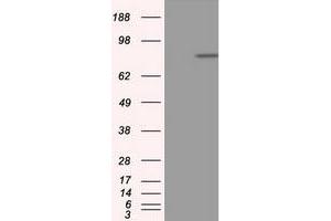 Western Blotting (WB) image for anti-Amyloid beta (A4) Precursor Protein (APP) antibody (ABIN1496881) (APP anticorps)