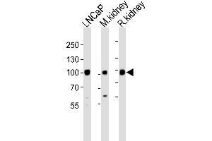 Western blot analysis of lysates from LNCaP, M. (MME anticorps  (N-Term))