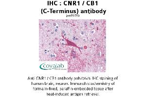 Image no. 1 for anti-Cannabinoid Receptor 1 (CNR1) (C-Term) antibody (ABIN1733176) (CNR1 anticorps  (C-Term))