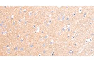 Immunohistochemistry of paraffin-embedded Human brain tissue using CD56 Polyclonal Antibody at dilution 1:30 (CD56 anticorps)