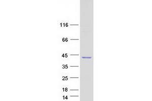 Validation with Western Blot (GMPR2 Protein (Transcript Variant 4) (Myc-DYKDDDDK Tag))