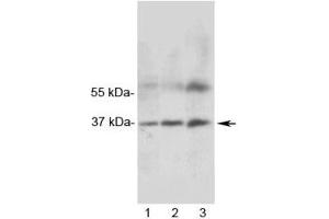 Western blot testing of 1) rat heart, 2) rat skeletal muscle and 3) human MCF7 lysate with MRGX1 antibody. (MRGPRX1 anticorps)