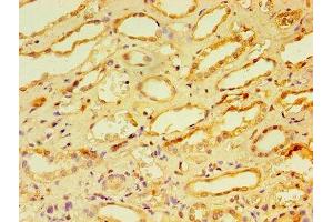 Immunohistochemistry of paraffin-embedded human kidney tissue using ABIN7146703 at dilution of 1:100 (CA12 anticorps  (AA 25-301))