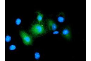 Image no. 2 for anti-Baculoviral IAP Repeat-Containing 5 (BIRC5) antibody (ABIN1501247) (Survivin anticorps)