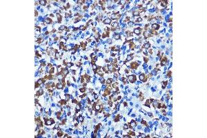 Immunohistochemistry of paraffin-embedded rat ovary using NEK2 Rabbit pAb  at dilution of 1:100 (40x lens). (NEK2 anticorps  (C-Term))