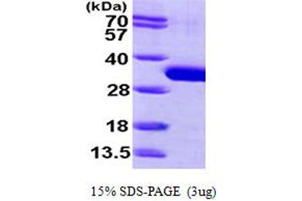 SBDS Protein (AA 1-250) (His tag)