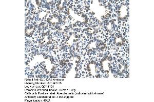 Human Lung (SLC43A3 anticorps  (N-Term))