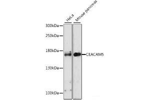 Western blot analysis of extracts of various cell lines using CEACAM5 Polyclonal Antibody at dilution of 1:1000. (CEACAM5 anticorps)