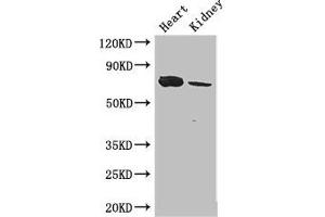 Western Blot Positive WB detected in: Mouse heart tissue, Mouse kidney tissue All lanes: MED17 antibody at 2. (MED17 anticorps  (AA 411-651))