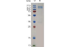 Human R Protein, hFc Tag on SDS-PAGE under reducing condition. (MST1R Protein (AA 25-957) (Fc Tag))