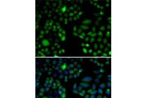 Immunofluorescence analysis of U2OS cells using EPC1 Polyclonal Antibody (EPC1 anticorps)