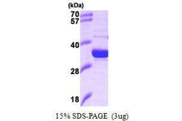 HMOX2 Protein (AA 1-264)