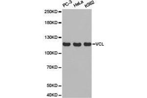 Western Blotting (WB) image for anti-Vinculin (VCL) antibody (ABIN1875315) (Vinculin anticorps)