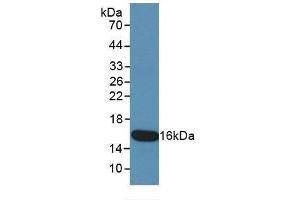 Detection of Recombinant KRT15, Human using Monoclonal Antibody to Cytokeratin 15 (CK15) (KRT15 anticorps  (AA 274-399))