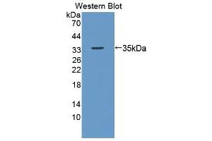 Detection of Recombinant Ki67P, Mouse using Polyclonal Antibody to Ki-67 Protein (Ki-67) (Ki-67 anticorps  (AA 1-247))