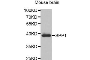Western blot analysis of extracts of Mouse brain tissue, using SPP1 antibody. (Osteopontin anticorps)