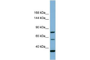 Host:  Rabbit  Target Name:  MYO16  Sample Type:  COLO205 Whole cell lysates  Antibody Dilution:  1. (Myosin XVI anticorps  (Middle Region))