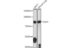 Western blot analysis of extracts of various cell lines, using Zyxin Rabbit mAb (ABIN1682627, ABIN3015962, ABIN3015963 and ABIN7101467) at 1:1000 dilution. (ZYX anticorps)