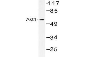 Western blot (WB) analysis of Akt1 antibody in extracts from HepG2 cells. (AKT1 anticorps)