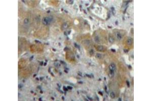 Used in DAB staining on fromalin fixed paraffin-embedded Liver tissue (PLGF anticorps  (AA 43-162))