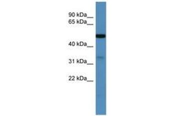 ZDHHC3 anticorps  (C-Term)