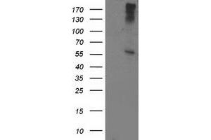 Western Blotting (WB) image for anti-ATPase, H+ Transporting, Lysosomal 56/58kDa, V1 Subunit B1 (ATP6V1B1) antibody (ABIN1496775) (ATP6V1B1 anticorps)