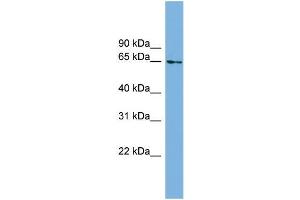 Human Heart; WB Suggested Anti-C8orf45 Antibody Titration: 0. (C8orf45 anticorps  (Middle Region))