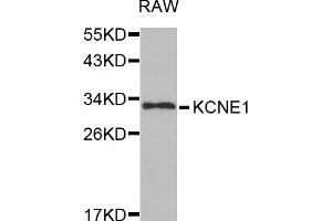 Western blot analysis of extracts of RAW264. (KCNE1 anticorps)