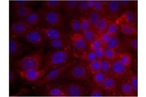 Image no. 2 for anti-Epidermal Growth Factor Receptor (EGFR) (AA 1068-1072) antibody (ABIN197228) (EGFR anticorps  (AA 1068-1072))