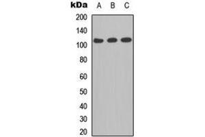Western blot analysis of CD41 LC 1 expression in A549 (A), MCF7 (B), PC12 (C) whole cell lysates. (CD41 LC 1 (C-Term) anticorps)