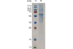 Human SC (441-659) Protein, hFc Tag on SDS-PAGE under reducing condition. (SCUBE2 Protein (AA 441-659) (Fc Tag))