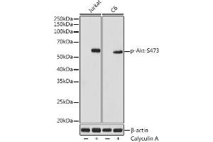 Western blot analysis of extracts of various cell lines, using Phospho-Akt-S473 antibody (ABIN7265522) at 1:1000 dilution. (AKT 1/2/3 anticorps  (pSer472))