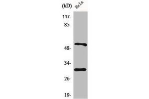 Western Blot analysis of HeLa cells using Caspase-10 B/C Polyclonal Antibody (Caspase 1 anticorps  (C-Term))